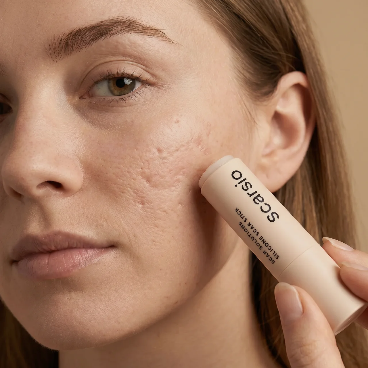 Woman applying silicone scar treatment stick to her cheek